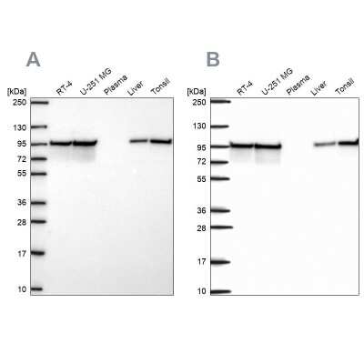 Western Blot: HSP90 beta Antibody [NBP2-68937]
