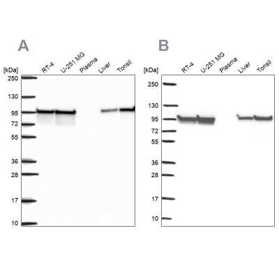 Western Blot: HSP90 beta Antibody [NBP2-68978]