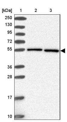 Western Blot: HSPA14 Antibody [NBP2-14106]