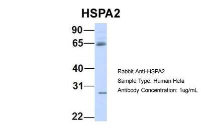 Western Blot: HSPA2 Antibody [NBP1-58213]