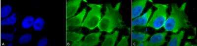 Immunocytochemistry/ Immunofluorescence: HSPA8/HSC71/Hsc70 Antibody (1F2-H5) [NBP2-12880]