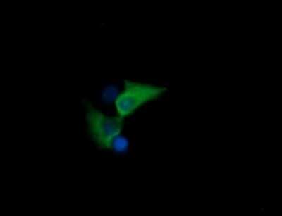 Immunocytochemistry/ Immunofluorescence: HSPA8/HSC71/Hsc70 Antibody (OTI1H3) - Azide and BSA Free [NBP2-70962]