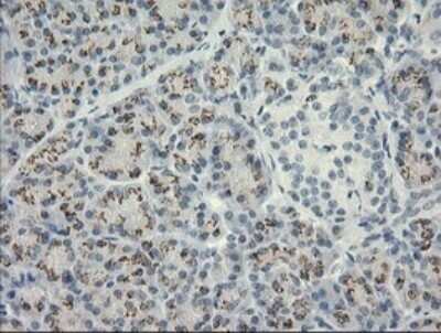 Immunohistochemistry: HSPA8/HSC71/Hsc70 Antibody (OTI1H3) [NBP2-45746]