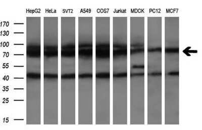 Western Blot: HSPA8/HSC71/Hsc70 Antibody (OTI1H3) [NBP2-45746]