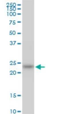 Western Blot: HSPB8/HSP22 Antibody (3C5) [H00026353-M12]
