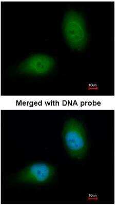 Immunocytochemistry/ Immunofluorescence: HSPB8/HSP22 Antibody [NBP1-30922]