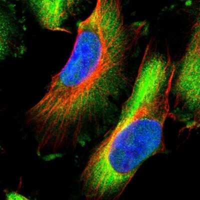 Immunocytochemistry/ Immunofluorescence: HSPB8/HSP22 Antibody [NBP1-84945]