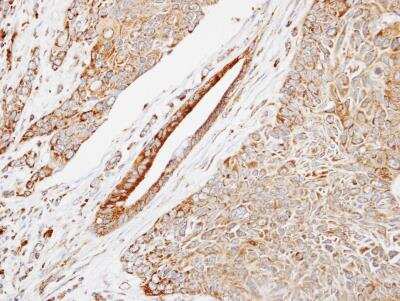 Immunohistochemistry-Paraffin: HSPB8/HSP22 Antibody [NBP1-30922]