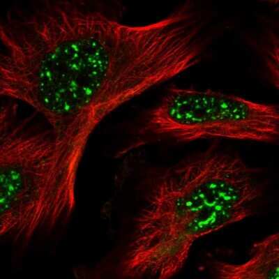 Immunocytochemistry/ Immunofluorescence: HSPC014 Antibody [NBP1-90734]