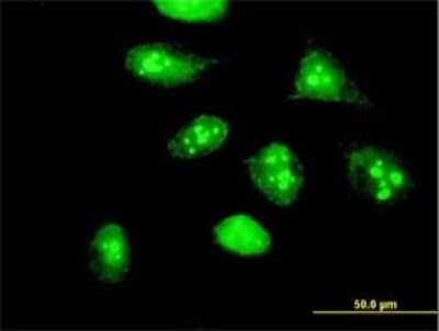 Immunocytochemistry/ Immunofluorescence: HSPC111 Antibody [H00051491-B01P]