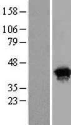 Western Blot: MERIT40/HSPC142 Overexpression Lysate [NBL1-08283]