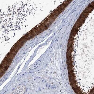Immunohistochemistry-Paraffin: HSPC280 Antibody [NBP1-81670]