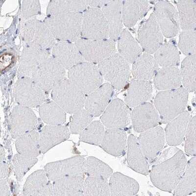 Immunohistochemistry-Paraffin: HSPC280 Antibody [NBP1-81670]