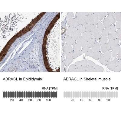 Immunohistochemistry-Paraffin: HSPC280 Antibody [NBP1-81670]