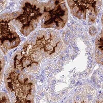 Immunohistochemistry-Paraffin: HSPC323 Antibody [NBP1-93687]