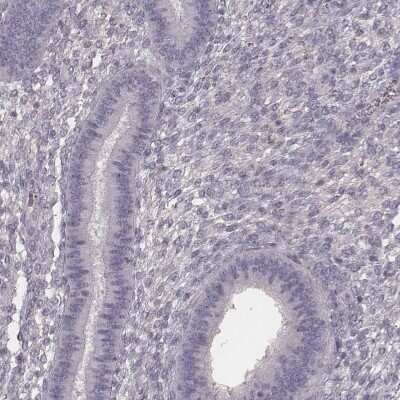 Immunohistochemistry-Paraffin: HSPC323 Antibody [NBP2-58735]