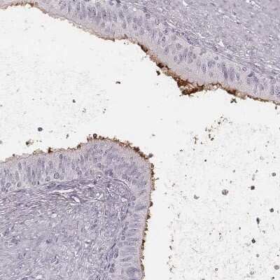 Immunohistochemistry-Paraffin: HSPC323 Antibody [NBP2-58735]