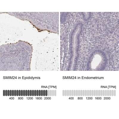 Immunohistochemistry-Paraffin: HSPC323 Antibody [NBP2-58735]