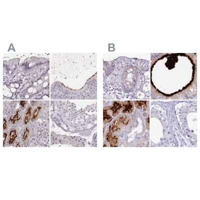 Immunohistochemistry-Paraffin: HSPC323 Antibody [NBP2-58735]