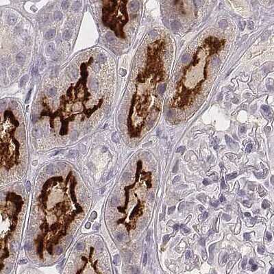 Immunohistochemistry-Paraffin: HSPC323 Antibody [NBP2-58735]