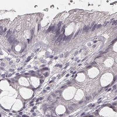 Immunohistochemistry-Paraffin: HSPC323 Antibody [NBP2-58735]