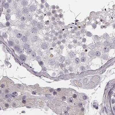Immunohistochemistry-Paraffin: HSPC323 Antibody [NBP2-58735]