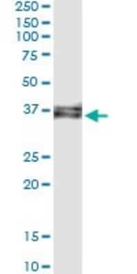 Immunoprecipitation: HSU79274 Antibody (2G4-1A1) [H00029902-M01]
