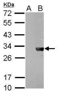 Western Blot: HSV Tag Antibody (212) [NBP2-43734]