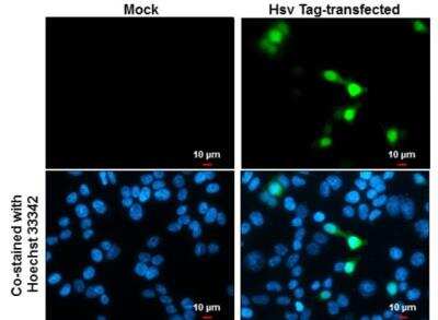Immunocytochemistry/ Immunofluorescence: HSV Tag Antibody (223) [NBP2-43816]