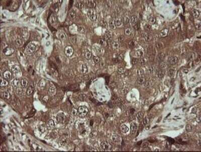 Immunohistochemistry: HTF9C Antibody (OTI1C3) - Azide and BSA Free [NBP2-71830]