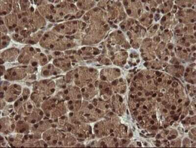 Immunohistochemistry: HTF9C Antibody (OTI1C3) - Azide and BSA Free [NBP2-71830]