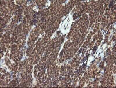 Immunohistochemistry: HTF9C Antibody (OTI1C3) [NBP2-46015]