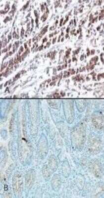Immunohistochemistry: HTRA2/Omi Antibody (196C429) - Azide and BSA Free [NBP2-80782]