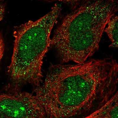 Immunocytochemistry/ Immunofluorescence: HUCE1 Antibody [NBP2-55730]