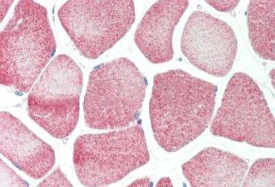 Immunohistochemistry-Paraffin: HUCE1 Antibody [NBP2-87610]