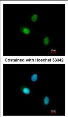 Immunocytochemistry/ Immunofluorescence: HUNK Antibody [NBP2-16904]