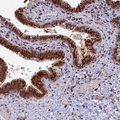 Immunohistochemistry: HUNK Antibody [NBP2-14111]
