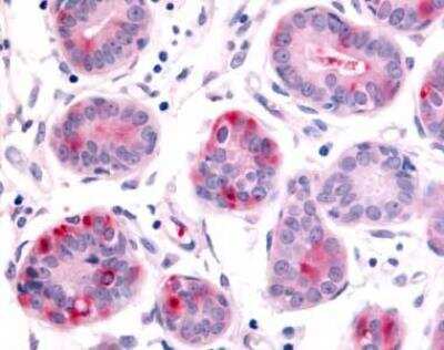 Immunohistochemistry-Paraffin: HUNK Antibody - BSA Free [NLS7095]
