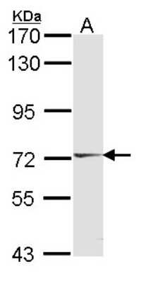 Western Blot: HUNK Antibody [NBP2-16904]