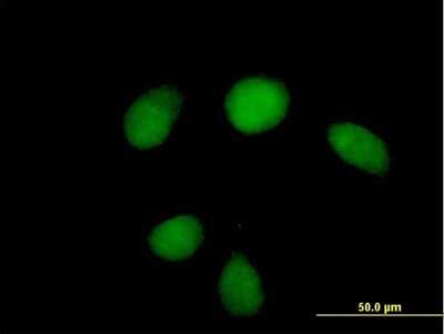 Immunocytochemistry/ Immunofluorescence: HUS1 Antibody [H00003364-B01P]
