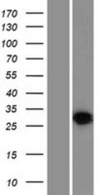 Western Blot: HVCN1 Overexpression Lysate [NBP2-06036]