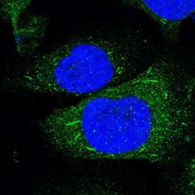 Immunocytochemistry/ Immunofluorescence: HVEM/TNFRSF14 Antibody [NBP1-88874]