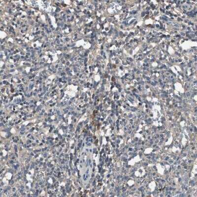 Immunohistochemistry-Paraffin: HVEM/TNFRSF14 Antibody [NBP1-88874]
