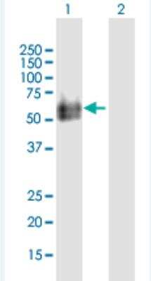 Western Blot: HYAL2 Antibody [H00008692-B02P-50ug]