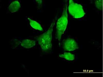Immunocytochemistry/ Immunofluorescence: HYAL3 Antibody [H00008372-B01P]