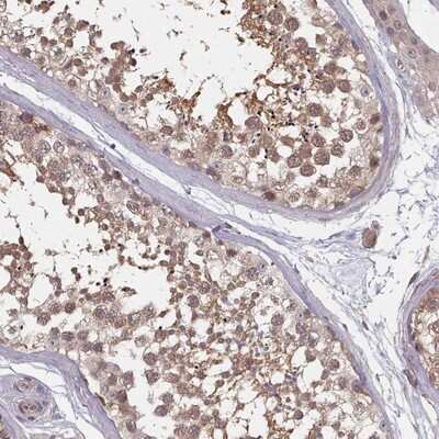 Immunohistochemistry-Paraffin: HYAL3 Antibody [NBP2-14112]