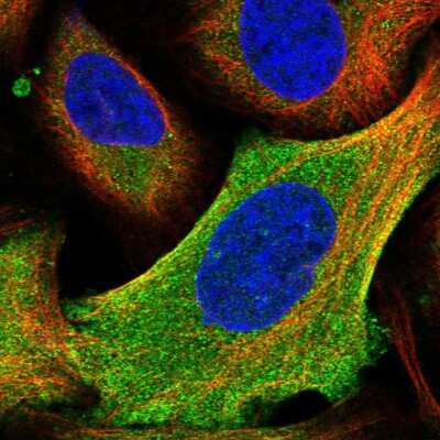Immunocytochemistry/ Immunofluorescence: HYI Antibody [NBP1-81659]