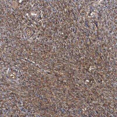 Immunohistochemistry: HYI Antibody [NBP1-81659]