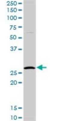 Western Blot: HYI Antibody [H00081888-D01P]