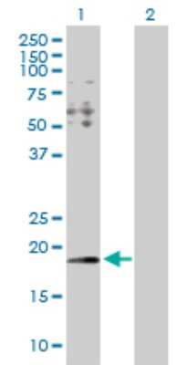 Western Blot: HYI Antibody [H00081888-D01P]
